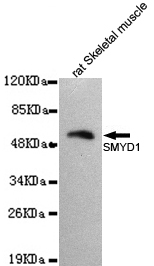 SMYD1 Monoclonal Antibody